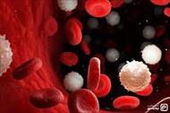 تحقیق سرطان خون (لوسمی) چیست